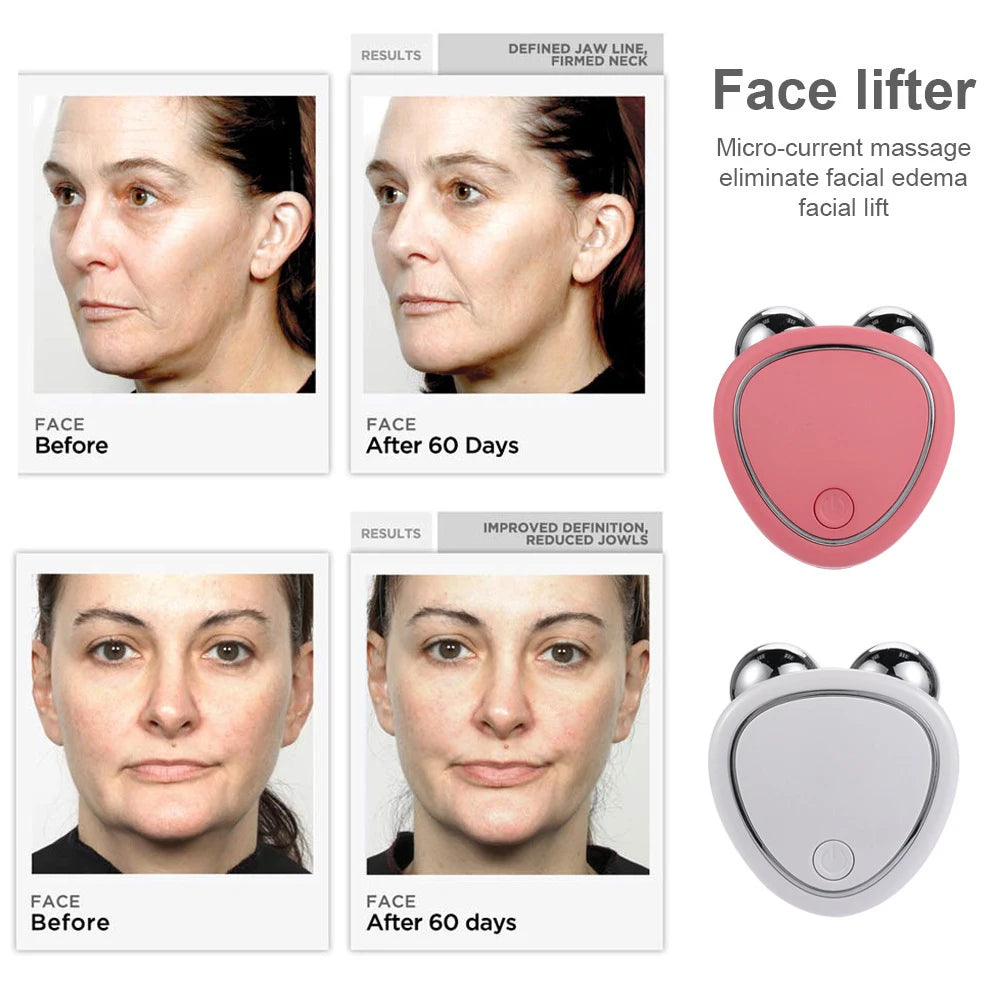 \EMS Face Lifting Machine | Microcurrent Roller for Skin Rejuvenation